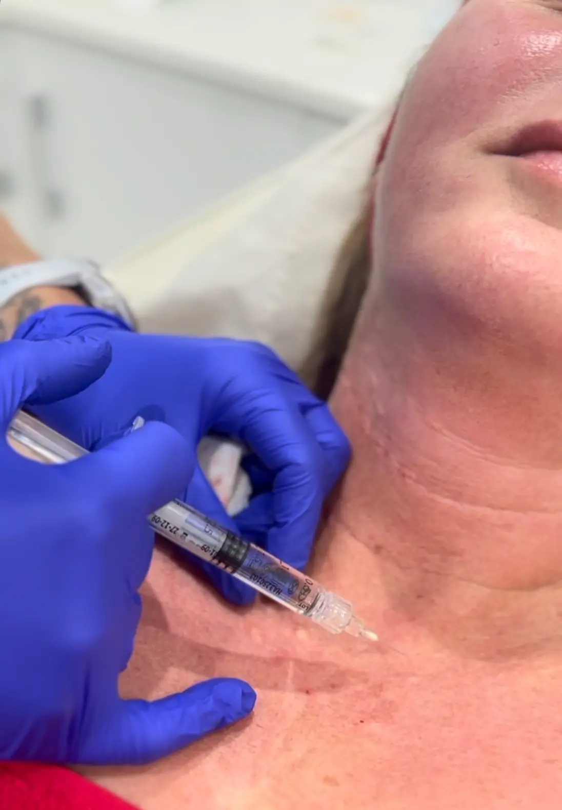 Injectable skin rejuvenation treatment at Face Medical Aesthetics